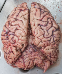 cerebro tejido 