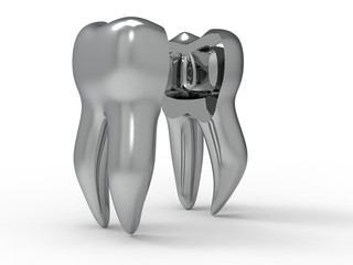 3D rendering - tooth section concept