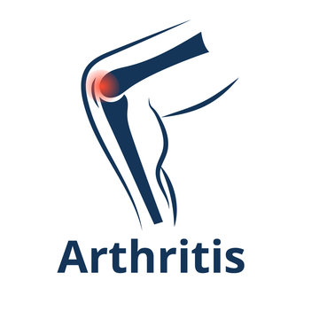 Knee Arthritis Vector Icon. Knee Joint Pain Concept