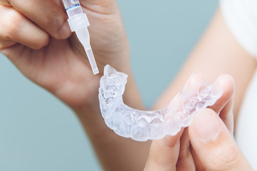 Tooth whitening gel being applied to a tooth mold in preparation for being placed in the mouth.