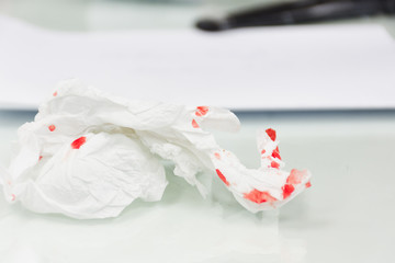 Blood on the table tissue