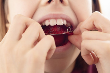 Child with removable orthodontic appliance in mouth. Concept of healthy teeth and a beautiful smile. 