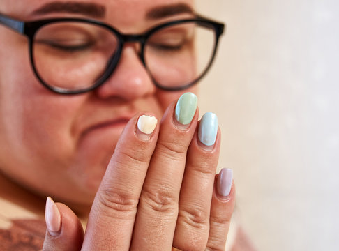 Close-up Of Unhappy Young Woman Looking At A Broken Fingernail And Sadness . Multicolor Nails Manicure And Broken Nail