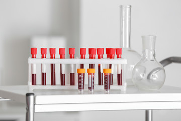 Test tubes with blood samples on table in laboratory