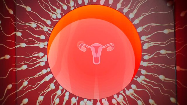 Image of the uterus of a woman to whom many spermotoids move.