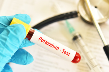 Blood sample tube for potassium test