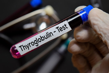 Thyroglobulin - Test text with blood sample. Top view isolated on black background. Healthcare/Medical concept