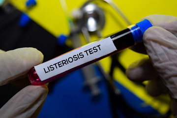 Listeriosis Test text with blood sample. Top view isolated on office desk background....