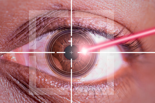 Laser Or Lasik Eye Surgery Concept, L Laser Beam Shining Into African America Male Dark Brown Eyes