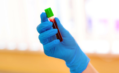 Hand in blue latex gloves holding blood sample vial in modern clinic background. Closeup.