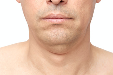 double fat chin