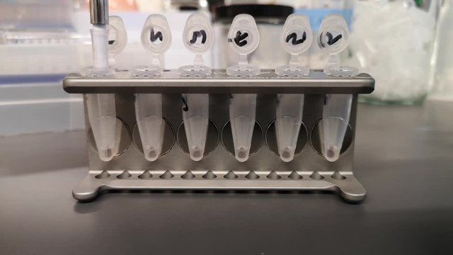 DNA purification with magnetic beads. Tubes in a magnetic rack, taking out the liquid with a pipette, laboratory video technique