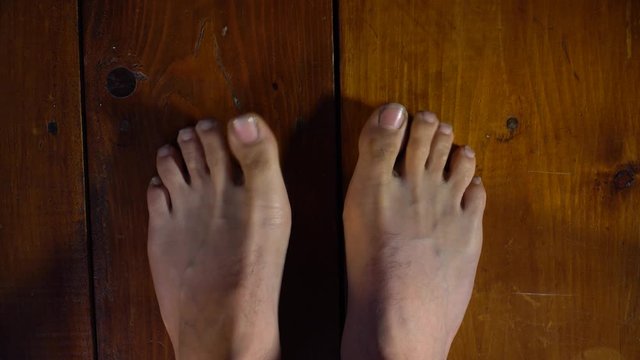 Legs of a young man. Huge nasty nails on his feet. Neglected legs of a young guy