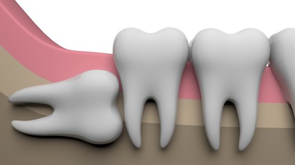 Wisdom tooth horizontal, 3D-rendering, white background