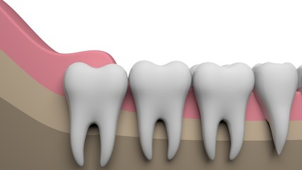 Wisdom tooth, 3D-rendering, white background