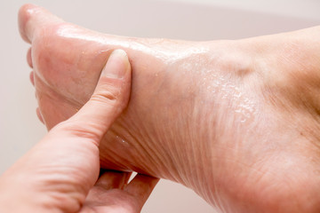 Woman using honey to scrub the dead skin off her feet