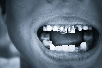 Naklejka premium A close up of the mouth with teeth On a black background