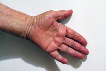 Fototapeta premium The process of aging of human skin - wrinkled hands of a very old man who lived 90-100 years with dry skin covered with wrinkles and spots