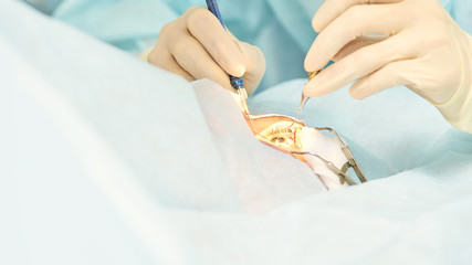 Ophthalmology laser microscope operation. Doctor in clinic. Patient eye treatment. Myopia and...