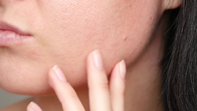 Skin texture with enlarged pores. Close-up of a woman's face.