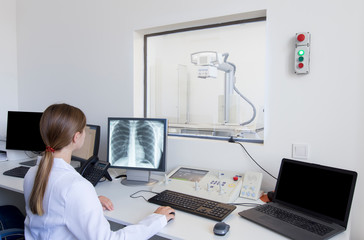 Young woman doctor watching on chest X-ray snapshot
