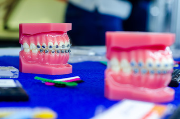 Demonstration teeth model of orthodontic bracket or brace