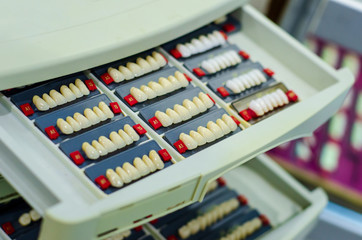 Close-up of implanted teeth. Denture manufacturing process.