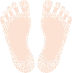 カサカサの足裏　輪郭なし