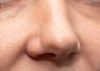 light skin female nose as background