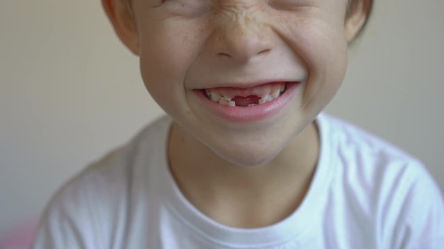 Little boy shows that some of his milk teeth had fallen out. Concept of tooth change in children
