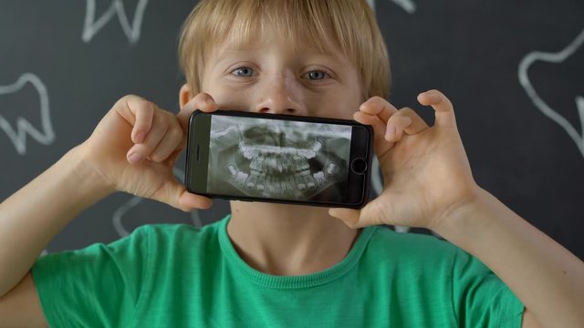Closeup shot of a little boy with missing milk teeth showing his x-ray dental picture. Concept of children tooth change