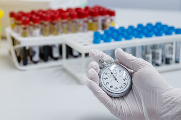  lab technician holding blood tube test and clock