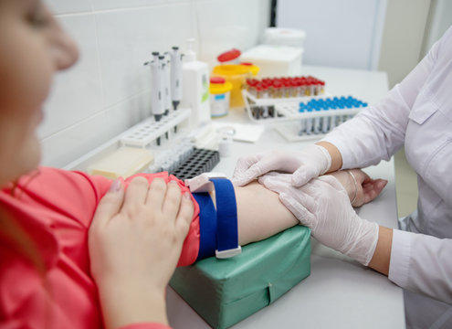 the young women take a blood test from the vein in the lab