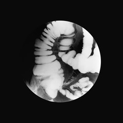 Fluoroscopic examination of lower gastrointestinal (GI) Tract, a spot film of lower...