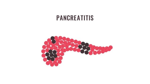 Pancreatitis awareness animation with pills forming pancreas. Medical solidarity concept. Human body organ treatment. Cartoon motion graphics.