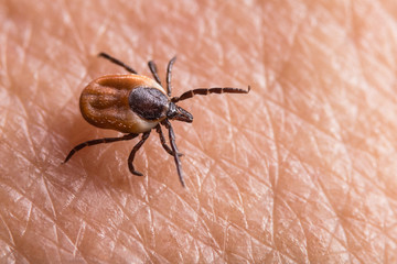 Female castor bean tick crawling on pink human skin. Ixodes ricinus. Dangerous insect parasite on...