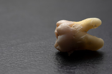 Torn human tooth on a black background. Side view. Tooth close-up.