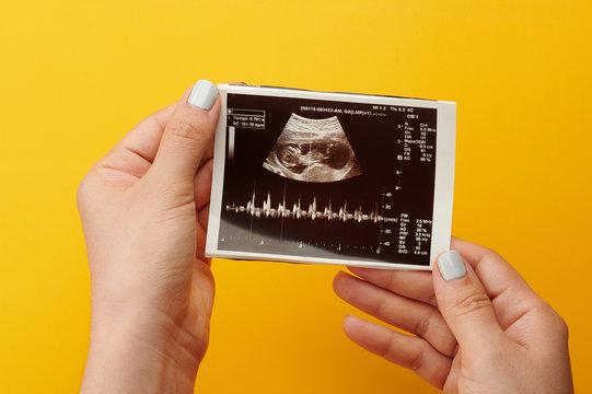 Ultrasound medical photo
