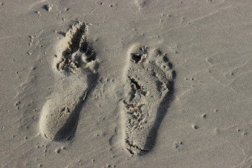 Fototapeta na wymiar Ordinary foot and foot with flat feet.