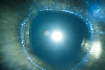 Easy to add overlay or screen filter over photos. Abstract sun burst. Digital lens flare...