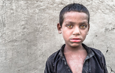 Obraz premium closeup of a poor staring hungry orphan boy in a refugee camp with sad expression on his face and his face and clothes are dirty and his eyes are full of pain