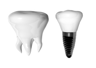  Dental implantation, prosthetics, tooth on a white background 3d illustration