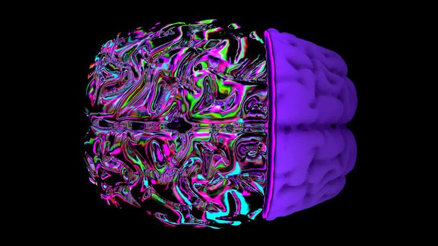 MRI scan of the brain