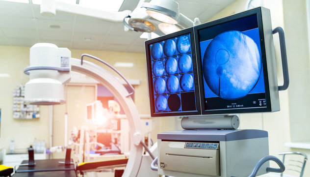 Medical devices for ultrasound examination on a background of the screen. Modern operating theatre. Closeup