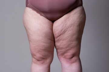 Fat female thigh on gray background