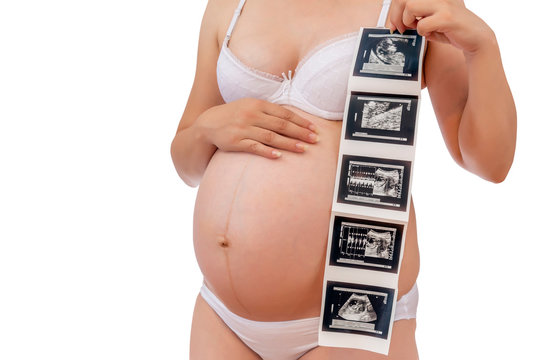 Pregnant woman in underwear holding ultrasound photo