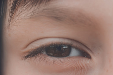 Boy age 10-11, close eye, white skin and squirrel eye.