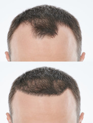 Fototapeta premium Bold problem treatment