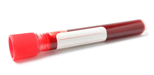 Test tube with blood on white background
