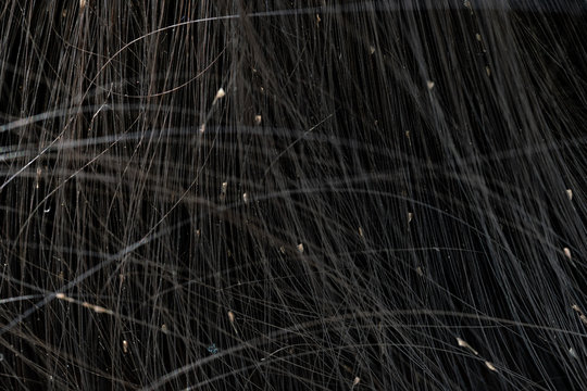 Louse egg on the hair causes itchy head.